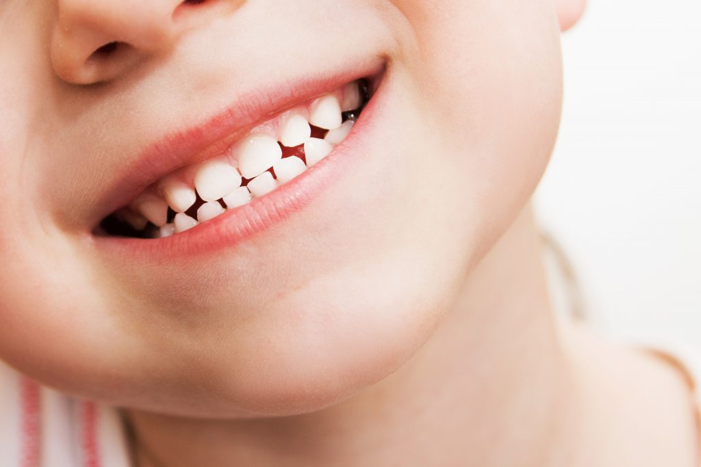 healthy kids teeth smiling