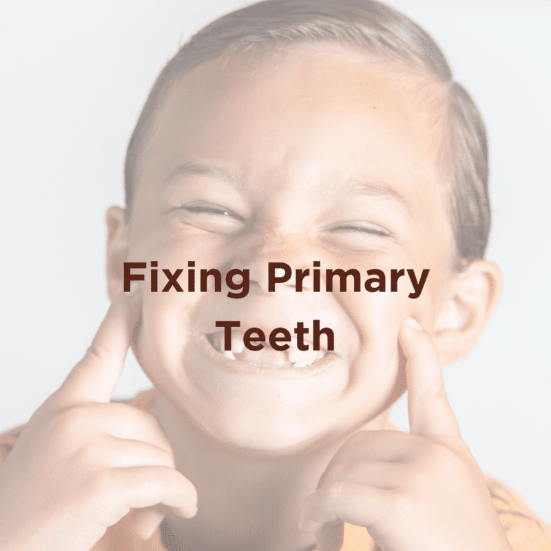 Fixing primary teeth